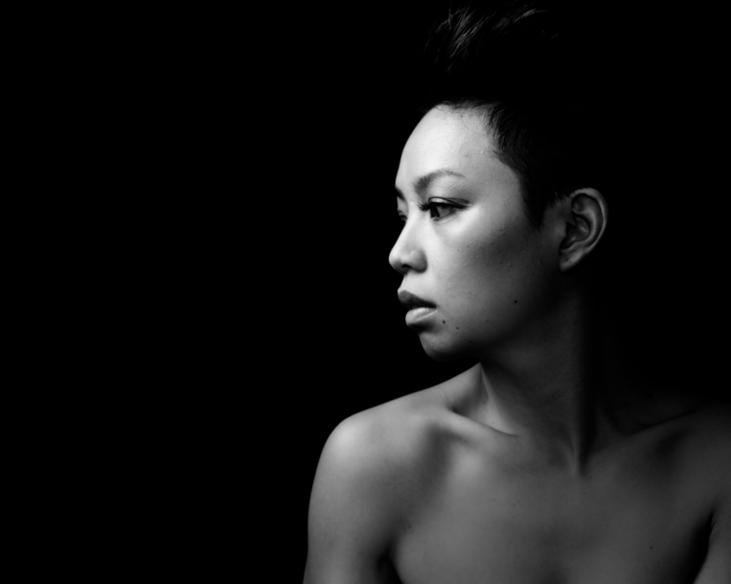 How to prevent keratosis pilaris?