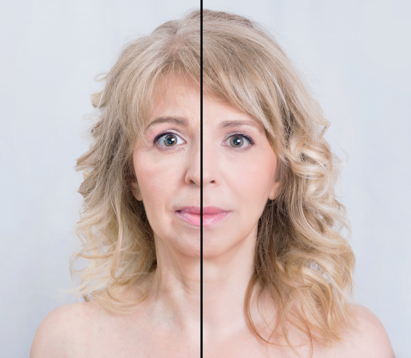 Are microneedling and microdermabrasion the same?