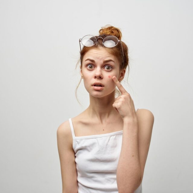 acne during ovulation