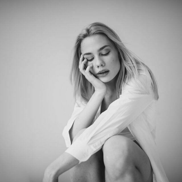 Which hormone causes pigmentation?