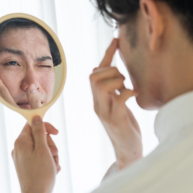 Can hydrafacial remove blackheads