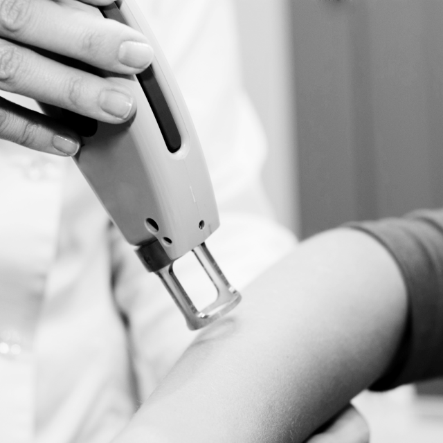 Does it hurt to remove hair with laser?