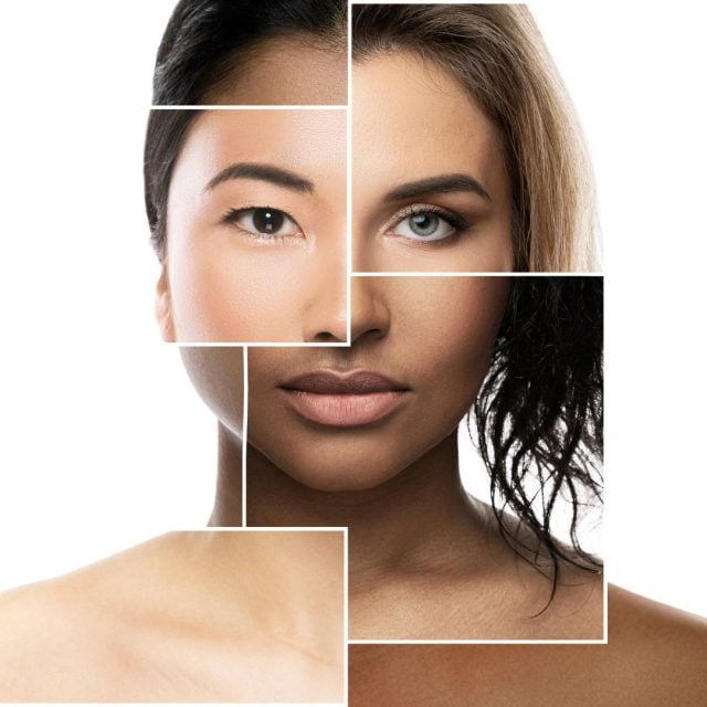 Do pores close up after laser hair removal?