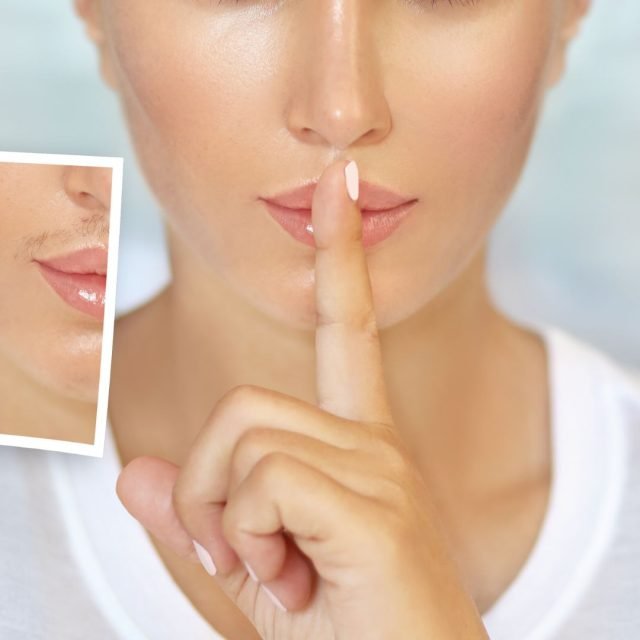 Does laser work on hormonal hair?