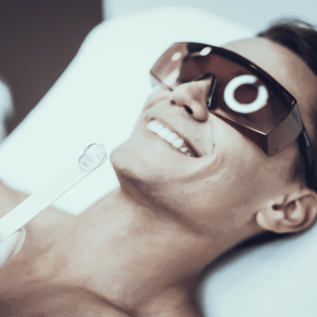 What does shedding after laser hair removal looks like? Skin perfection london