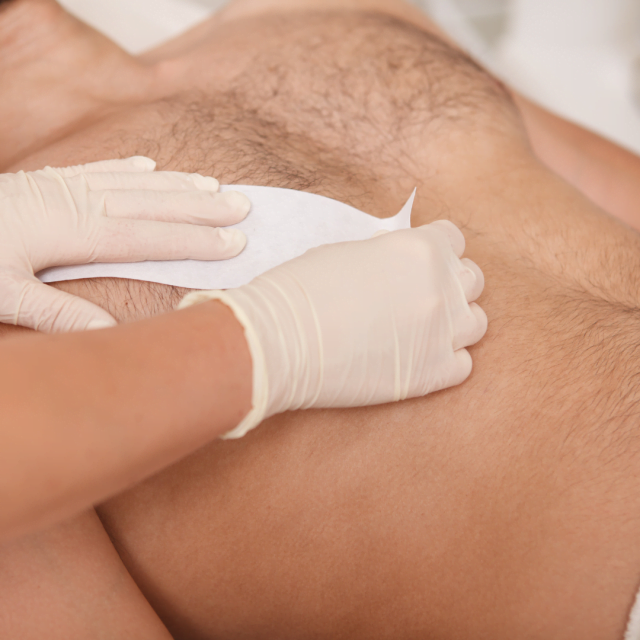 Is waxing better than laser hair removal?