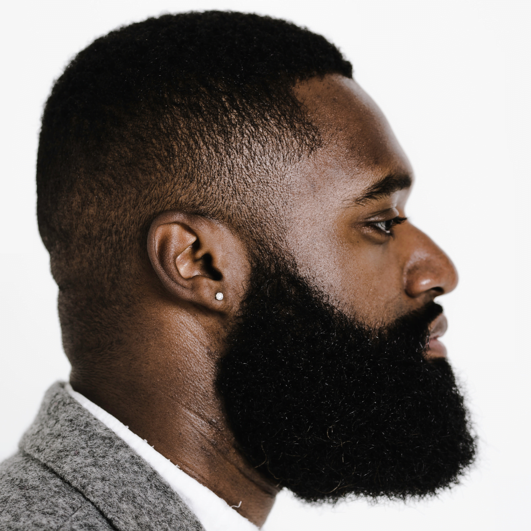 Laser hair removal to shape the beard Skin Perfection