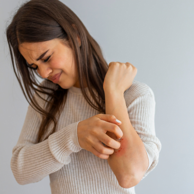 Laser hair removal with psoriasis