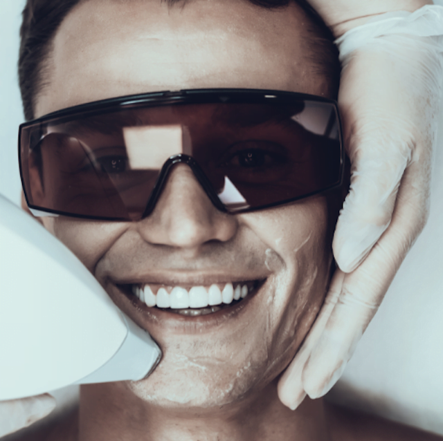 Laser hair removal treatment side effects skin perfection london