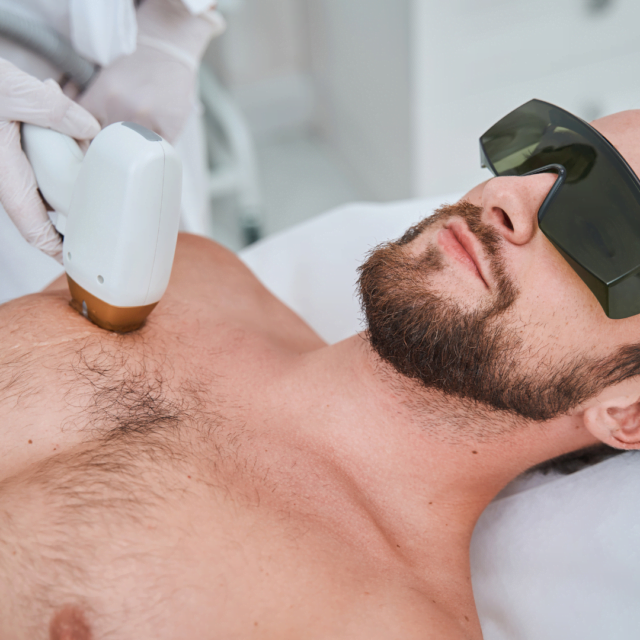 Does laser removal remove all hair?