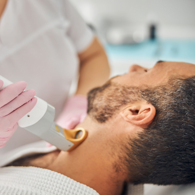 Laser hair removal results after 6 session