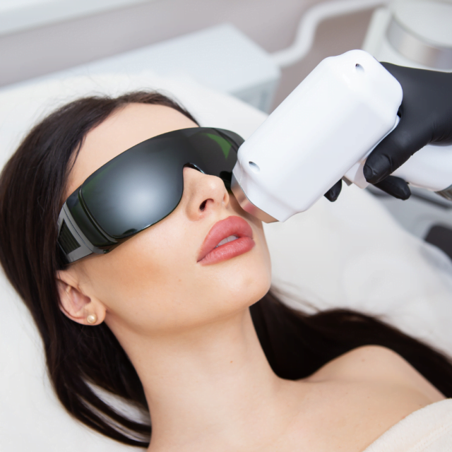 Do I have to shave my upper lip for laser?