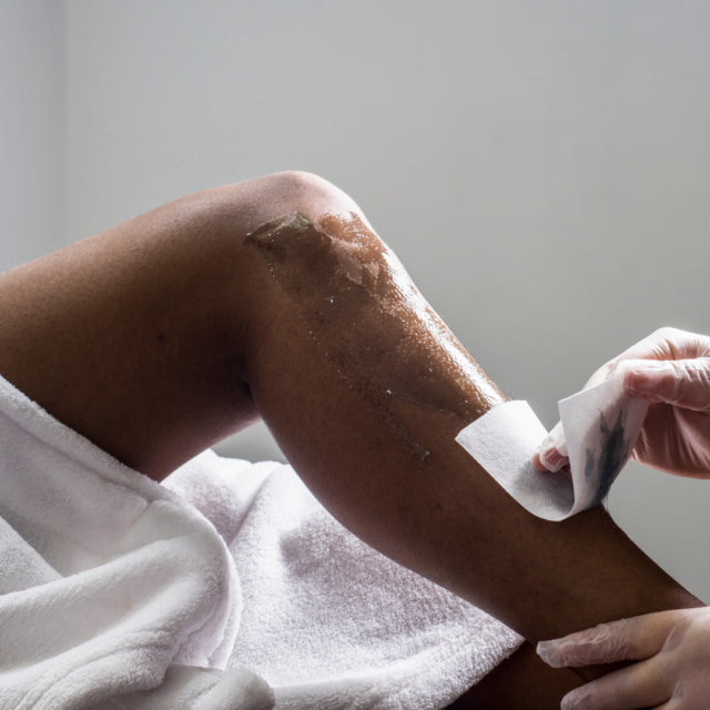 Why can't you wax after laser hair removal?