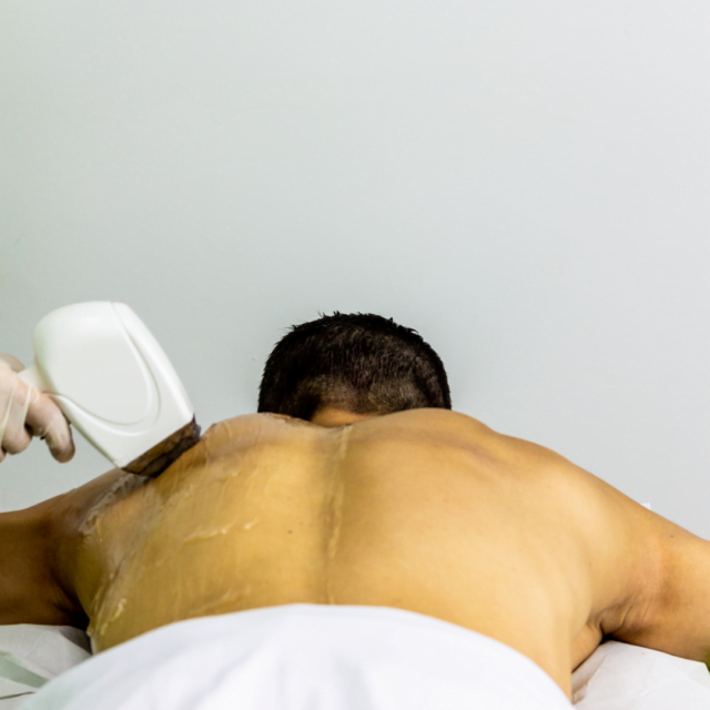 How do I prepare my back for laser hair removal?