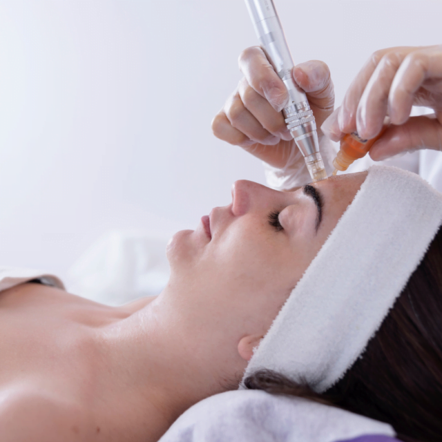 How long do Dermapen results last?
