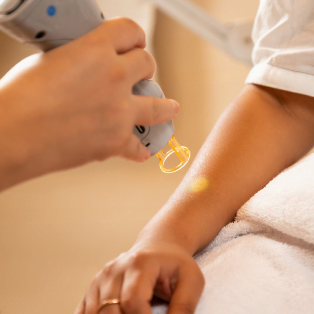 How to remove dead hair after laser?
