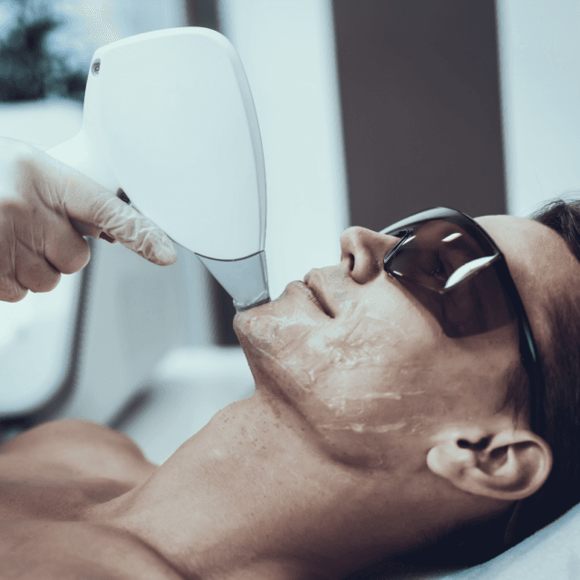 Do guys get laser hair removal on their face?