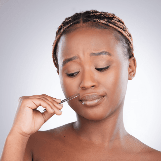 Does laser hair removal help if you have PCOS?