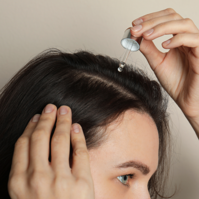 Hair restoration with Exosomes