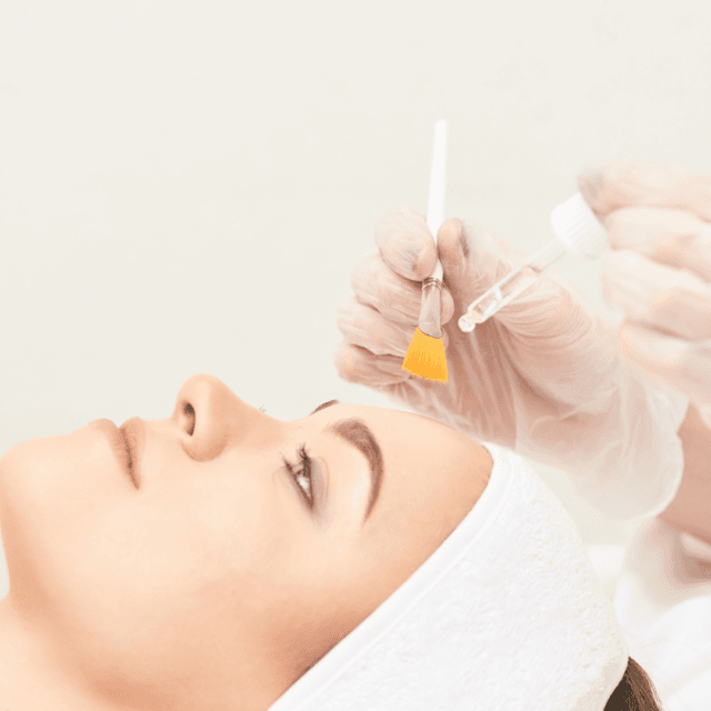 Which is better chemical peel or laser resurfacing?