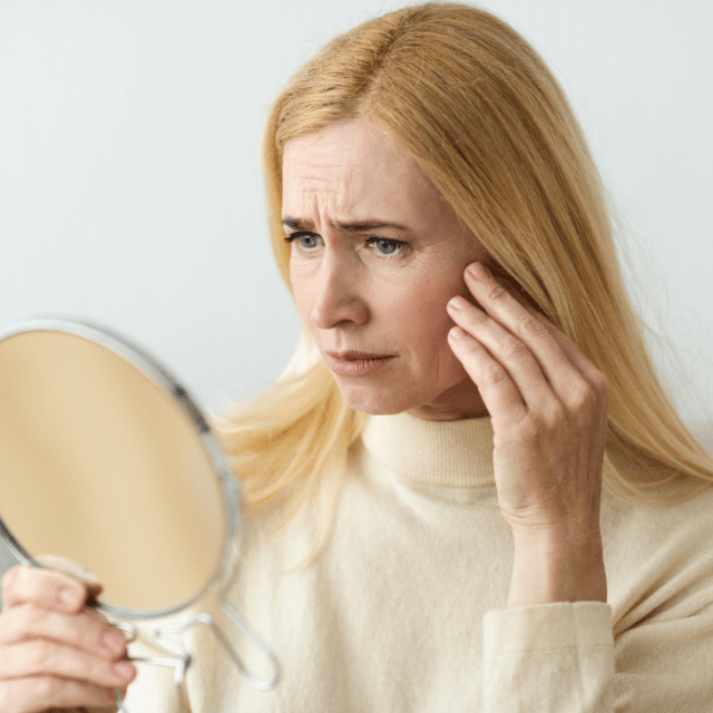Will polynucleotides get rid of wrinkles?