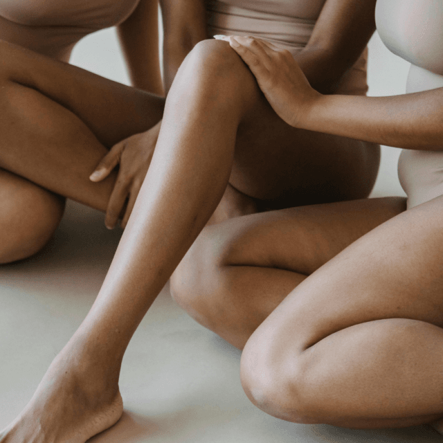 Laser hair removal and strawberry legs