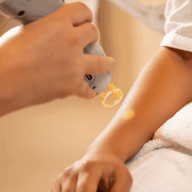 Is laser hair removal permanent or temporary?