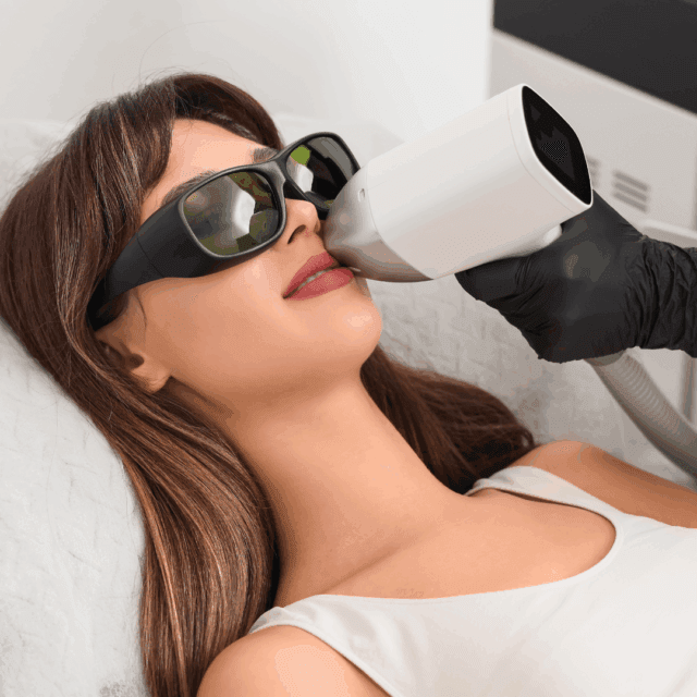 Preparation steps before a face laser hair removal session