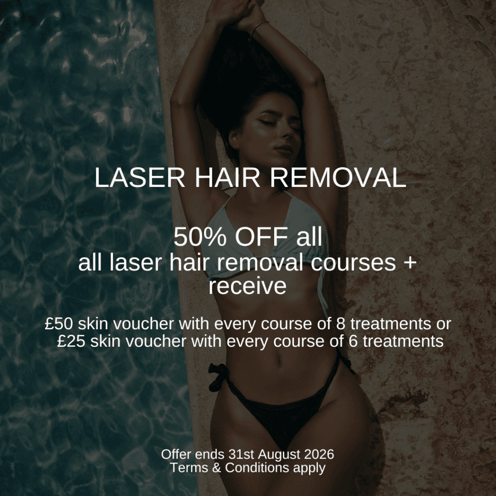 laser hair removal london